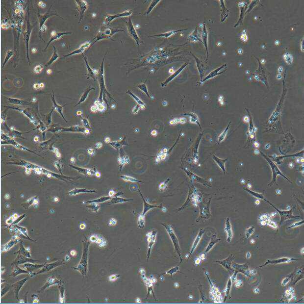 人造心脏100万元 中国已开始研制