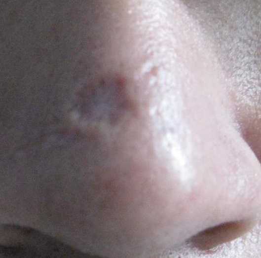 乡村振兴文惠科云平台与广东诺赛基因共祈大健康进基层