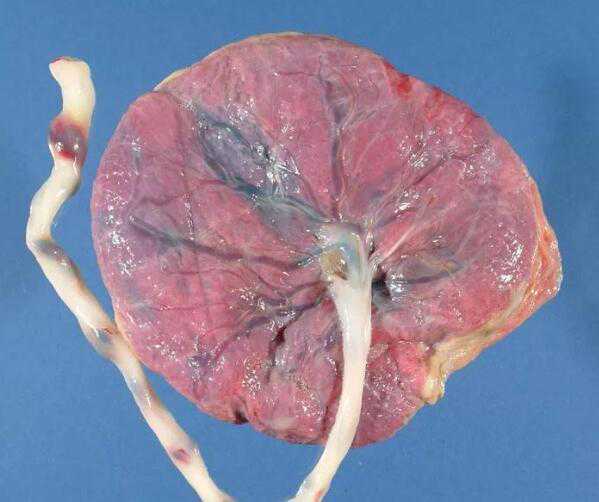 “乳”此健康 远离凶“腺”