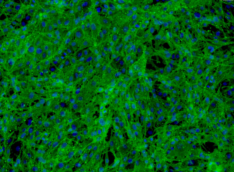 王友军与合作者开发出新型光遗传学工具来干预疾病