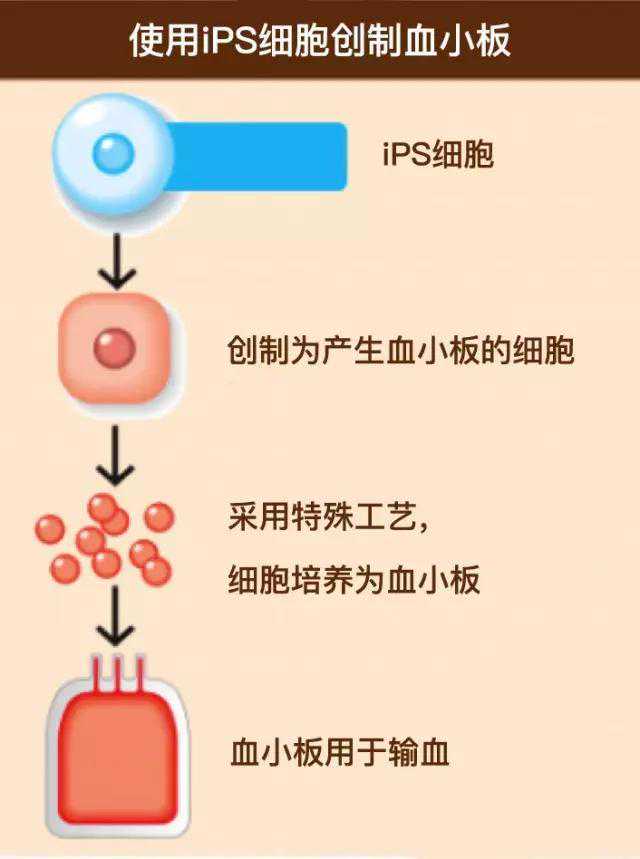 干眼症会改变眼睛角膜自愈方式