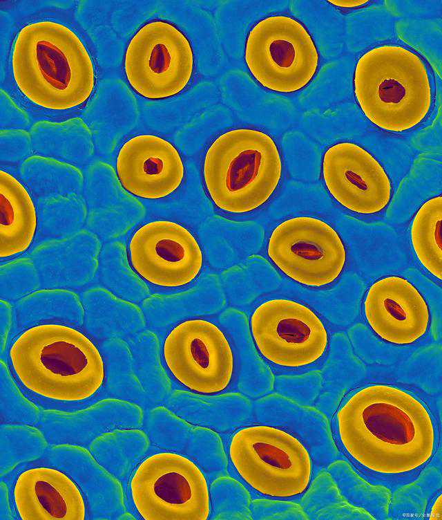 红斑狼疮的原因及诊治方法？