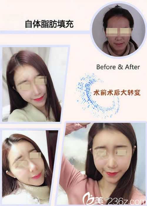 星奕昂研发生产一体化中心在外高桥自贸区生命科学园区启用 通用“现货型”创新细胞治疗产品有望量产