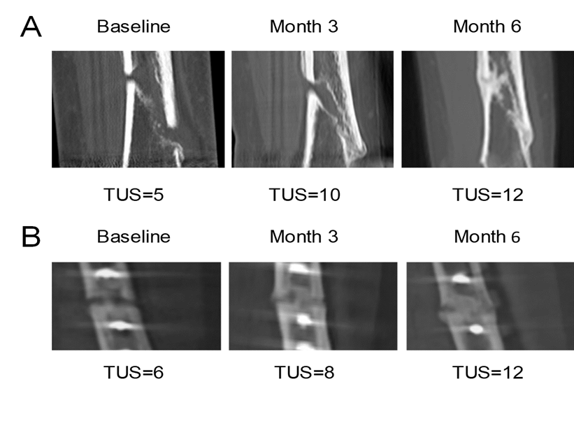 与奥运有关的5个生命故事，这就是感动世界125年的奥运精神